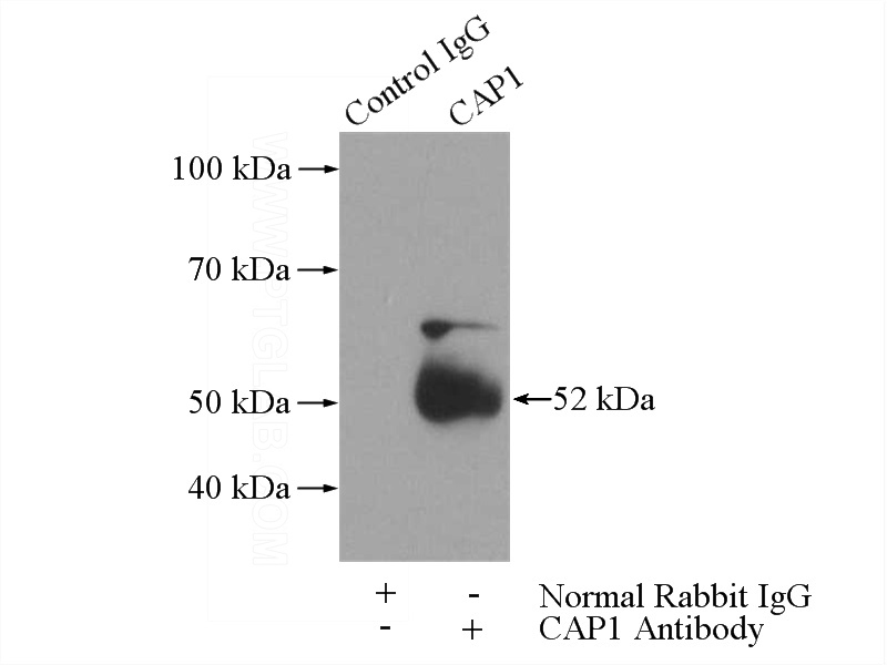 IP Result of anti-CAP1 (IP:Catalog No:108932, 3ug; Detection:Catalog No:108932 1:500) with A431 cells lysate 1520ug.