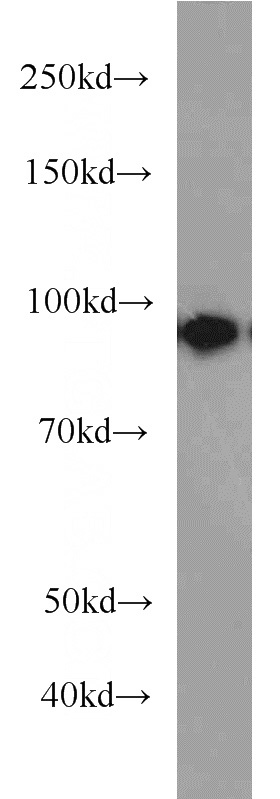 mouse lung tissue were subjected to SDS PAGE followed by western blot with Catalog No:117132(b-cat antibody) at dilution of 1:1000