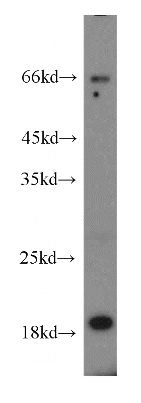 mouse brain tissue were subjected to SDS PAGE followed by western blot with Catalog No:110327(ENSA antibody) at dilution of 1:300