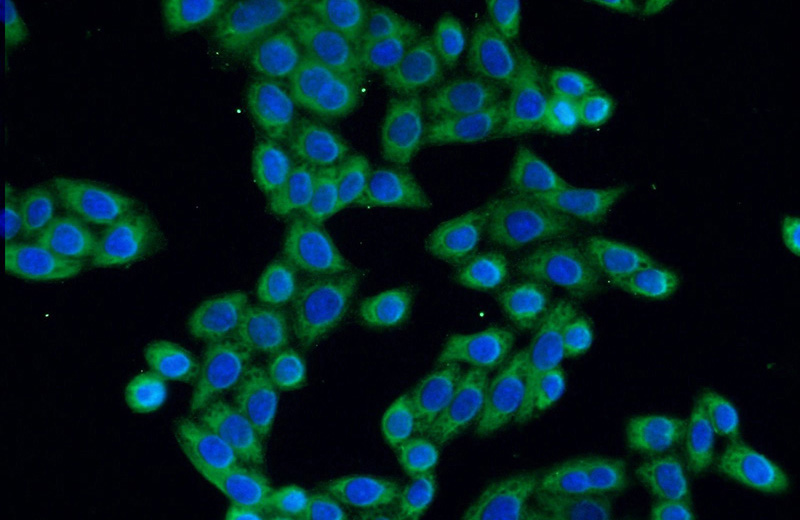 Immunofluorescent analysis of HeLa cells using Catalog No:110364(ERLIN1 Antibody) at dilution of 1:50 and Alexa Fluor 488-congugated AffiniPure Goat Anti-Rabbit IgG(H+L)