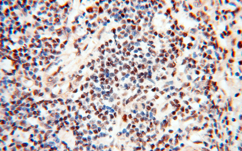 Immunohistochemical of paraffin-embedded human spleen using Catalog No:116128(TIMELESS antibody) at dilution of 1:50 (under 40x lens)
