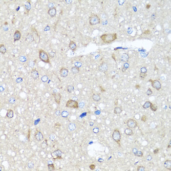 Immunohistochemistry - PRKAG1 Polyclonal Antibody 
