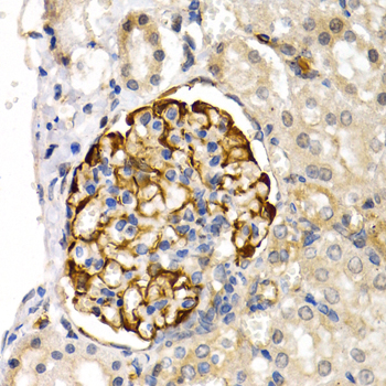 Immunohistochemistry - LIPG Polyclonal Antibody 