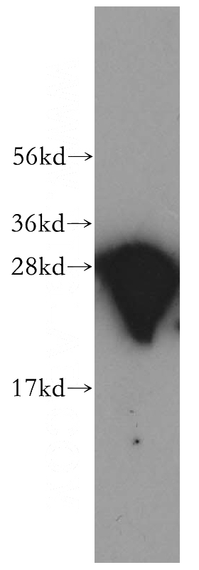 human brain tissue were subjected to SDS PAGE followed by western blot with Catalog No:108770(CACYBP antibody) at dilution of 1:500