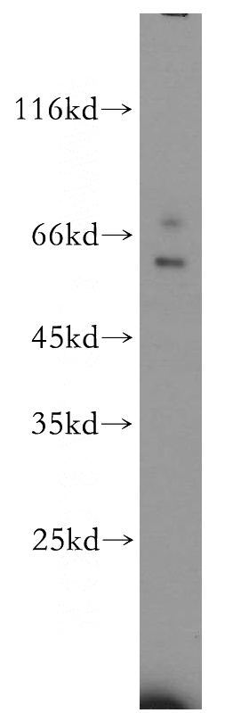 human liver tissue were subjected to SDS PAGE followed by western blot with Catalog No:112060(KIR2DL3 antibody) at dilution of 1:500