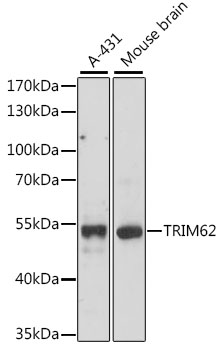 Western blot - TRIM62 Polyclonal Antibody 