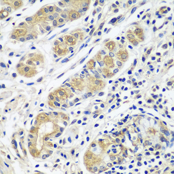 Immunohistochemistry - GPRC5A Polyclonal Antibody 