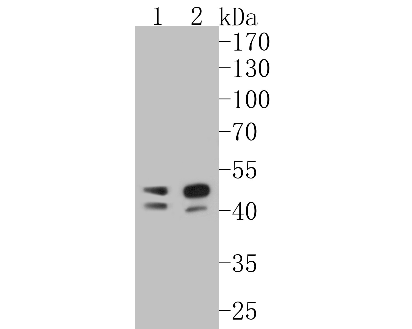 Fig1:; Western blot analysis of TMX4 on different lysates. Proteins were transferred to a PVDF membrane and blocked with 5% BSA in PBS for 1 hour at room temperature. The primary antibody ( 1/500) was used in 5% BSA at room temperature for 2 hours. Goat Anti-Rabbit IgG - HRP Secondary Antibody (HA1001) at 1:5,000 dilution was used for 1 hour at room temperature.; Positive control:; Lane 1: Daudi cell lysate; Lane 2: Human skin tissue lysate