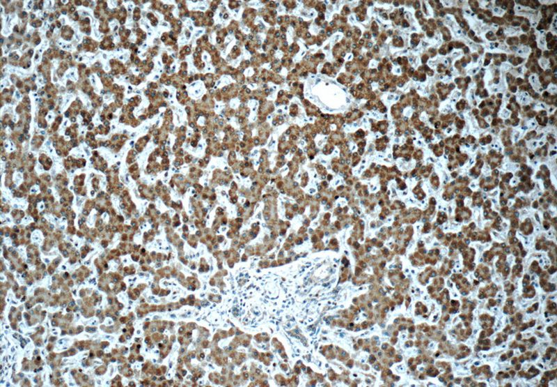 Immunohistochemistry of paraffin-embedded human liver tissue slide using Catalog No:114057(POMP Antibody) at dilution of 1:50