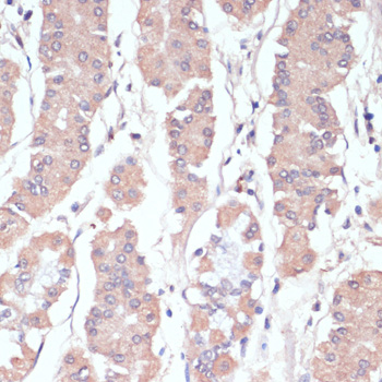 Immunohistochemistry - WNT5B Polyclonal Antibody 