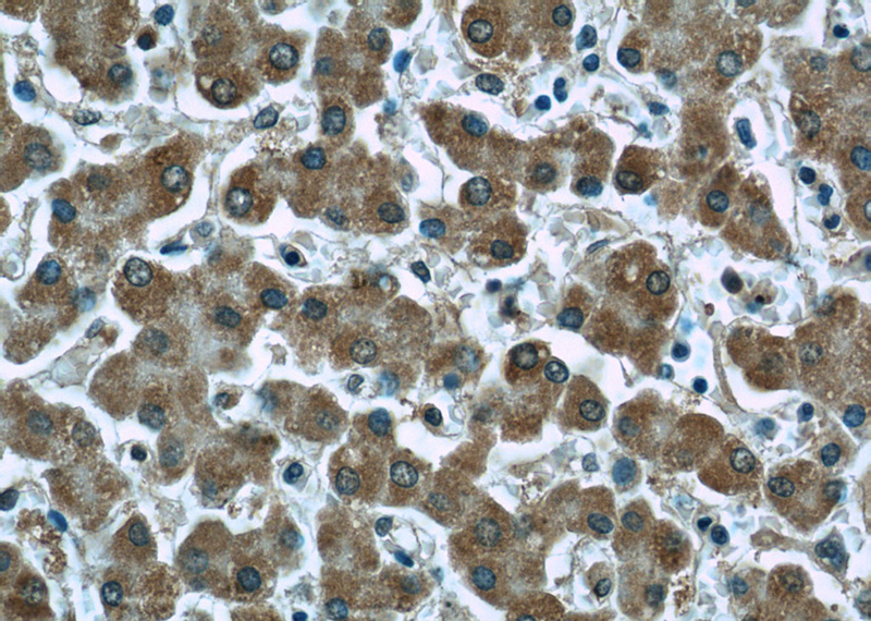 Immunohistochemistry of paraffin-embedded human liver tissue slide using Catalog No:107407(LONP1 Antibody) at dilution of 1:50(under 40x lens)