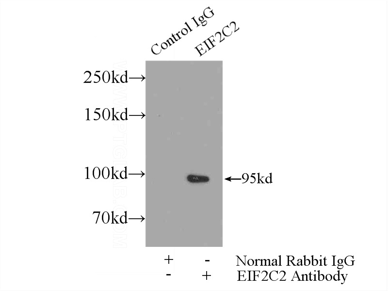 IP Result of anti-AGO2 (IP:Catalog No:107830, 5ug; Detection:Catalog No:107830 1:500) with HEK-293 cells lysate 1800ug.