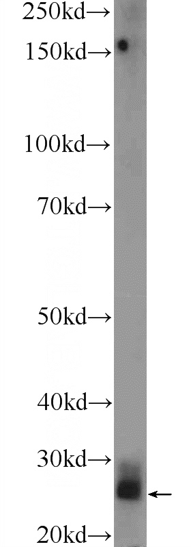 mouse lung tissue were subjected to SDS PAGE followed by western blot with Catalog No:116218(TPSD1 Antibody) at dilution of 1:300