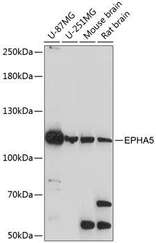 Western blot - EPHA5 Polyclonal Antibody 
