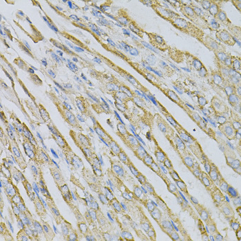 Immunohistochemistry - CDA Polyclonal Antibody 