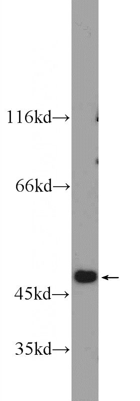mouse kidney tissue were subjected to SDS PAGE followed by western blot with Catalog No:110162(EAF2 Antibody) at dilution of 1:300