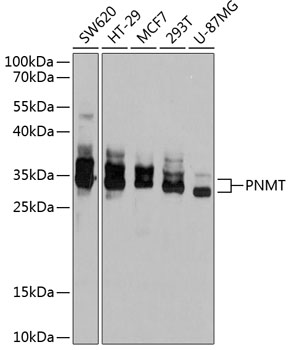 Western blot - PNMT Polyclonal Antibody 