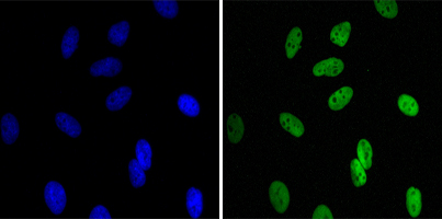 Immunofluorescence analysis of Hela cells using CBX1 mouse mAb (green). Blue