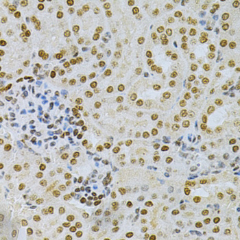 Immunohistochemistry - DKC1 Polyclonal Antibody 