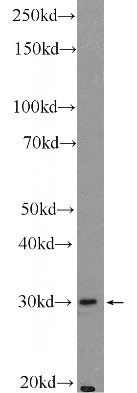 Raji cells were subjected to SDS PAGE followed by western blot with Catalog No:117151(BIVM Antibody) at dilution of 1:1000