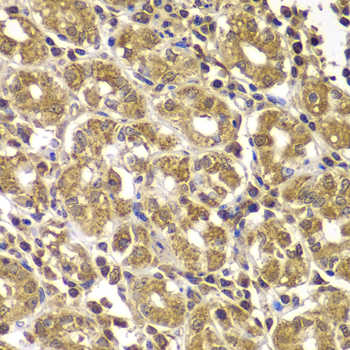Immunohistochemistry - HSPE1 Polyclonal Antibody 