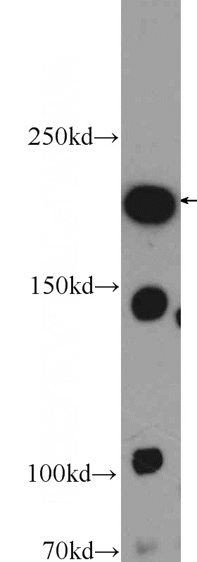 mouse brain tissue were subjected to SDS PAGE followed by western blot with Catalog No:113618(PC5 Antibody) at dilution of 1:300