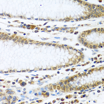 Immunohistochemistry - IFI44 Polyclonal Antibody 