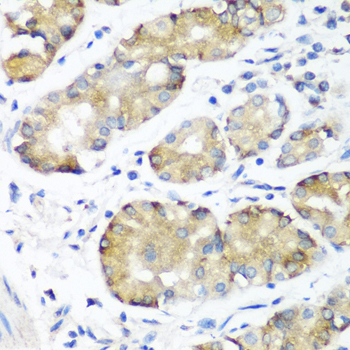 Immunohistochemistry - NOTCH2 Polyclonal Antibody 