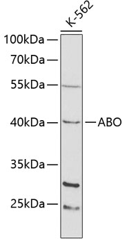 Western blot - ABO Polyclonal Antibody 