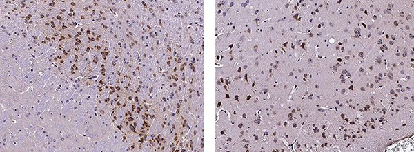 Neuroserpin / SerpinI1 Antibody, Rabbit MAb, Immunohistochemistry