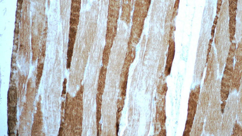 Immunohistochemistry of paraffin-embedded human skeletal muscle tissue slide using Catalog No:112928(MYH1 Antibody) at dilution of 1:50 (under 10x lens)