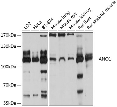 Western blot - ANO1 Polyclonal Antibody 