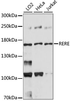 Western blot - RERE Polyclonal Antibody 