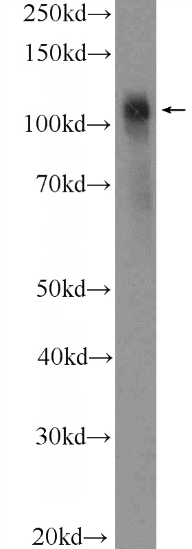 fetal human brain tissue were subjected to SDS PAGE followed by western blot with Catalog No:111884(JIP1 Antibody) at dilution of 1:300