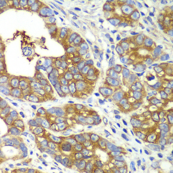Immunohistochemistry - QARS Polyclonal Antibody 