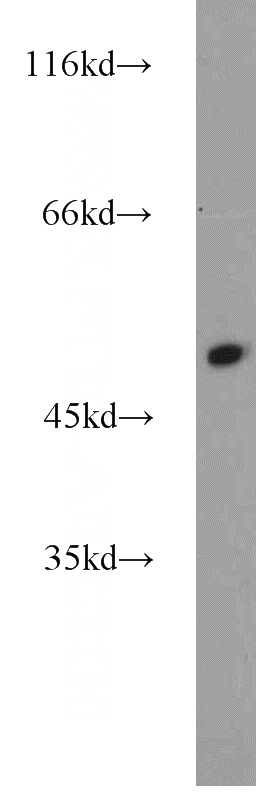 mouse kidney tissue were subjected to SDS PAGE followed by western blot with Catalog No:107875(Alpha-1-Antitrypsin antibody) at dilution of 1:1000