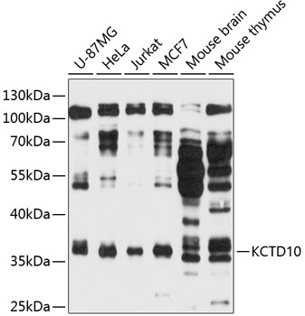 Western blot - KCTD10 Polyclonal Antibody 