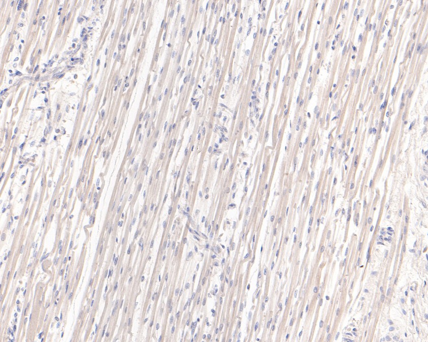 Fig3:; Immunohistochemical analysis of paraffin-embedded human fetal skeletal muscle tissue using anti-CLIC2 antibody. The section was pre-treated using heat mediated antigen retrieval with Tris-EDTA buffer (pH 9.0) for 20 minutes.The tissues were blocked in 1% BSA for 30 minutes at room temperature, washed with ddH; 2; O and PBS, and then probed with the primary antibody ( 1/400) for 30 minutes at room temperature. The detection was performed using an HRP conjugated compact polymer system. DAB was used as the chromogen. Tissues were counterstained with hematoxylin and mounted with DPX.