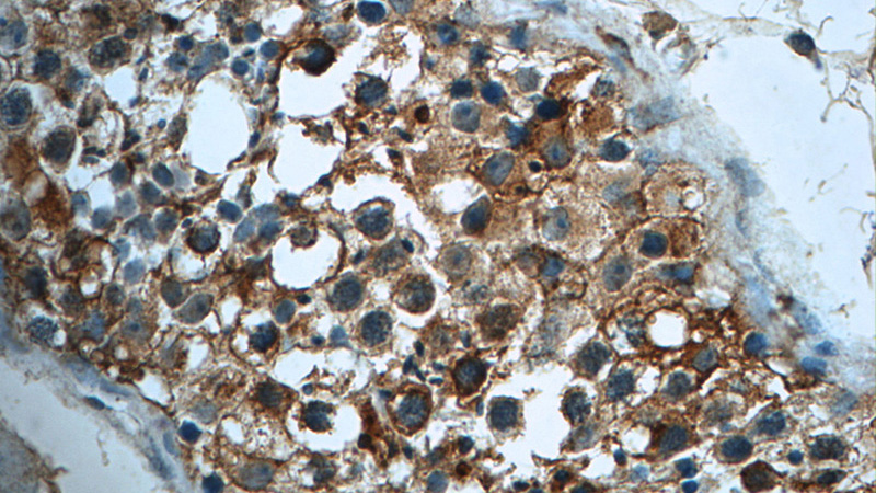 Immunohistochemistry of paraffin-embedded human testis tissue slide using Catalog No:113473(PAAF1 Antibody) at dilution of 1:50 (under 40x lens)