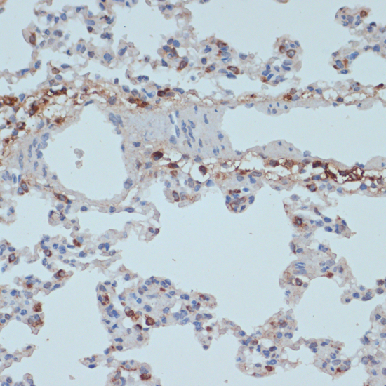 Immunohistochemistry - HLA-DRA Polyclonal Antibody 