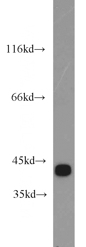 mouse brain tissue were subjected to SDS PAGE followed by western blot with Catalog No:111051(GOT2 antibody) at dilution of 1:1200