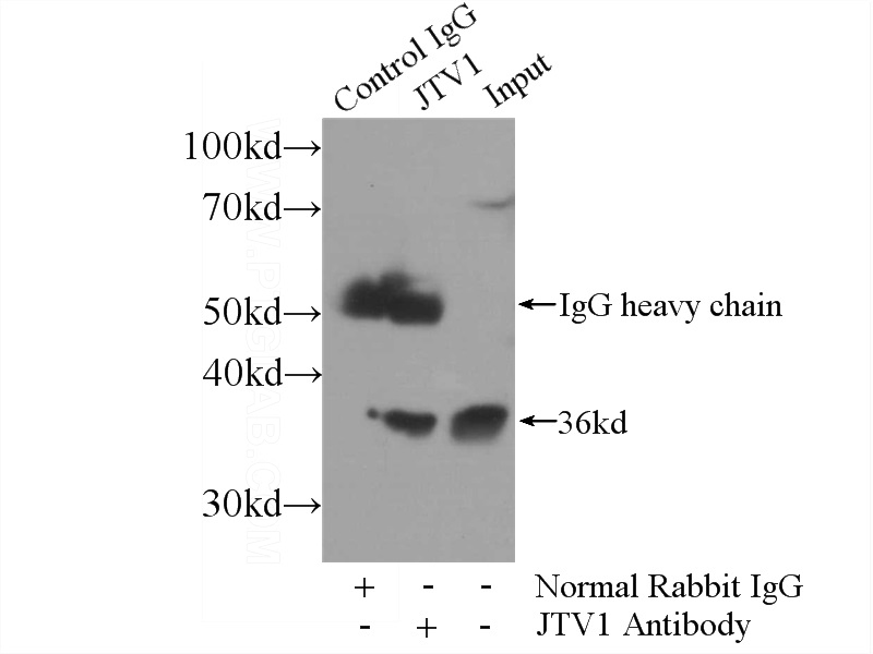IP Result of anti-JTV1 (IP:Catalog No:111898, 3ug; Detection:Catalog No:111898 1:1000) with HeLa cells lysate 800ug.