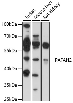 Western blot - PAFAH2 Polyclonal Antibody 