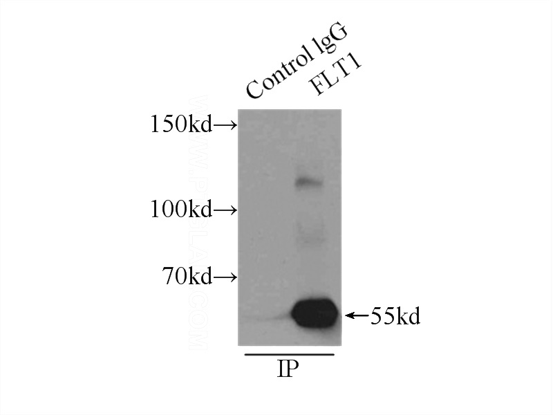 IP Result of anti-VEGFR1, FLT1 (IP:Catalog No:116739, 5ug; Detection:Catalog No:116739 1:500) with A549 cells lysate 3300ug.