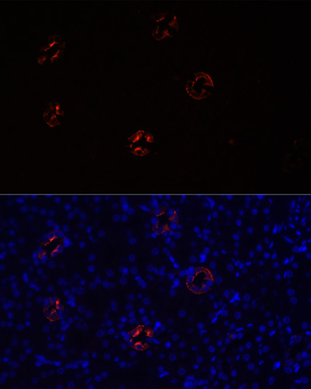 Immunofluorescence - AQP2 Polyclonal Antibody 