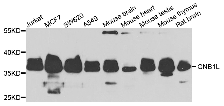 Western blot - GNB1L Polyclonal Antibody 
