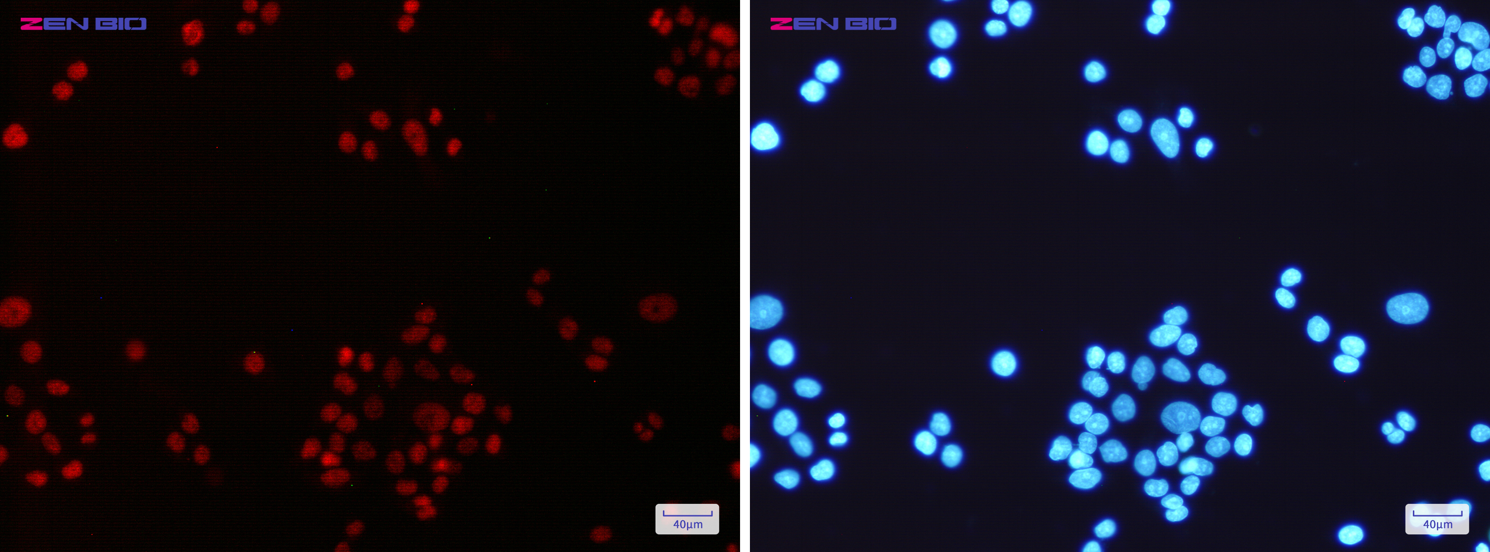 Immunocytochemistry of MLH1(green) in Hela cells using MLH1 Rabbit mAb at dilution 1/200, and DAPI(blue)
