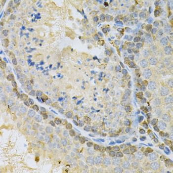 Immunohistochemistry - BUB1 Polyclonal Antibody 