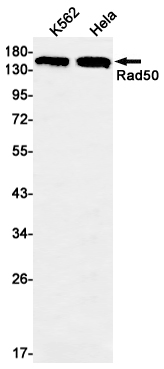 Western blot detection of Rad50 in K562,Hela cell lysates using Rad50 Rabbit mAb(1:1000 diluted).Predicted band size:154kDa.Observed band size:154kDa.