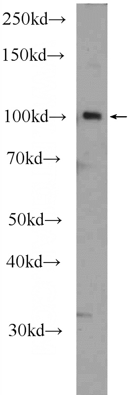 NIH/3T3 cells were subjected to SDS PAGE followed by western blot with Catalog No:115143(SFMBT2 Antibody) at dilution of 1:600